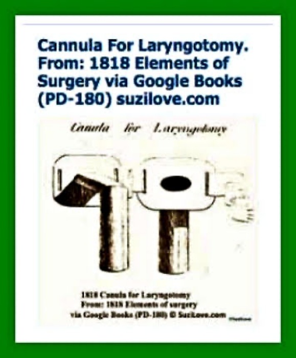 1818 Cannula For Laryngotomy. . 1818 Elements of Surgery By John Syng Dorsey. via Google Books (PD-150)